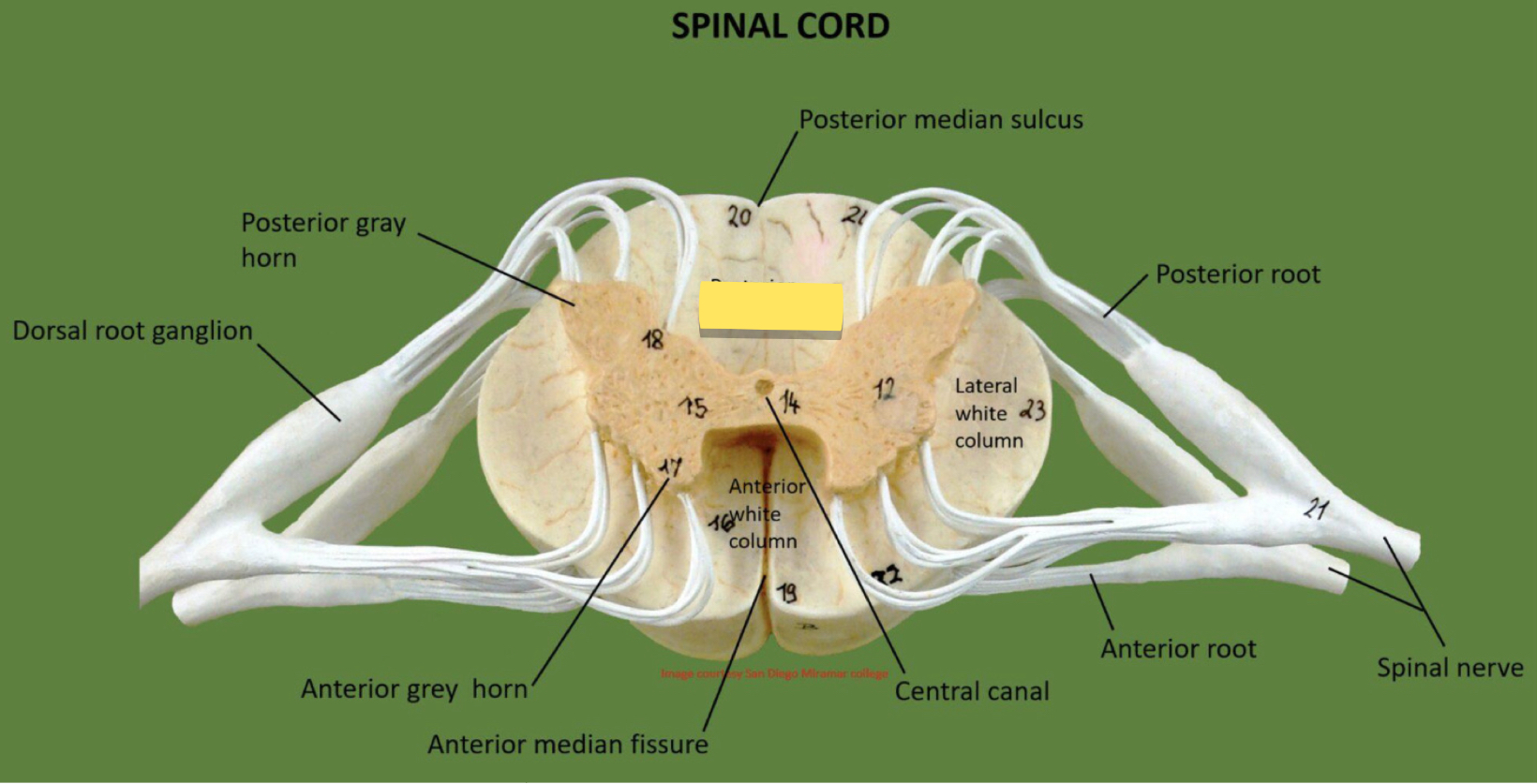 <p>Name this spinal cord part</p>