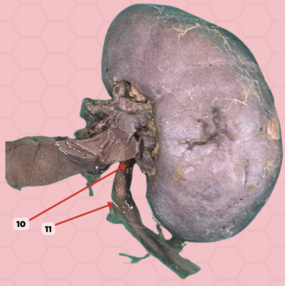 <p>Pinned structure 10 is a ?</p><p>a. bilateral alveolar organ</p><p>b. unilateral alveolar organ</p><p>c. unilateral tubular organ</p><p>d. bilateral tubular organ</p>