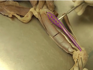 <p><span>Antebrachial Region (Forearm)</span></p>
