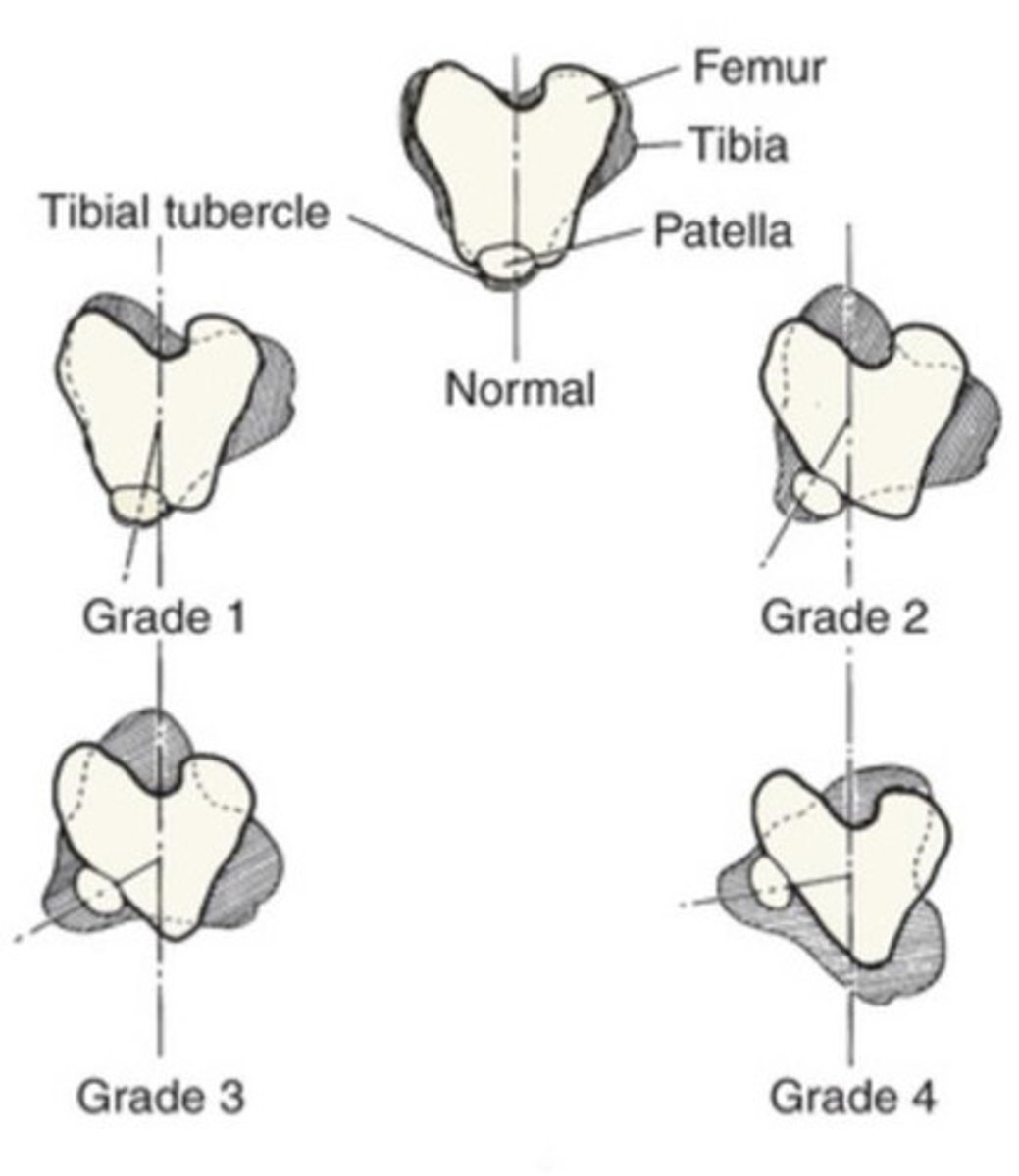 <p>DESCRIBE GRADES I-IV OF PATELLAR LUXATION</p>
