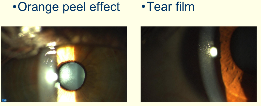 <p>What method is being observed and what structures are being viewed? </p>