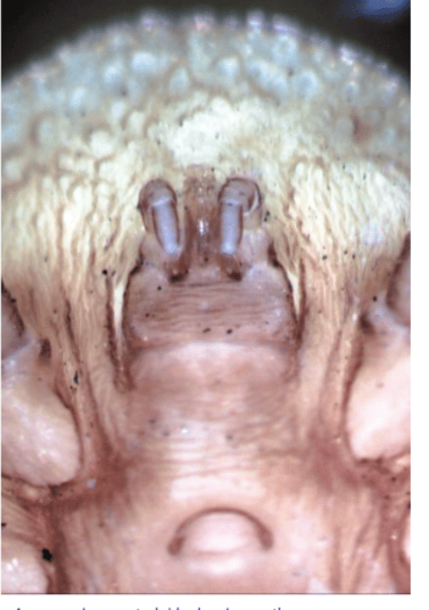 <p>• All stages remain around the roosting area;</p><p>• Nymphs and adults attack the host and feed during the night</p><p>• Larvae attach and feed on the host continuously for 5- 10 days =&gt; can cause paralysis;</p><p>• Most larvae can be found on the neck, head, under the wings etc =&gt; diagnosis;</p><p>• Vector for Borrelia anserina, Aegyptianella pullorum.</p>