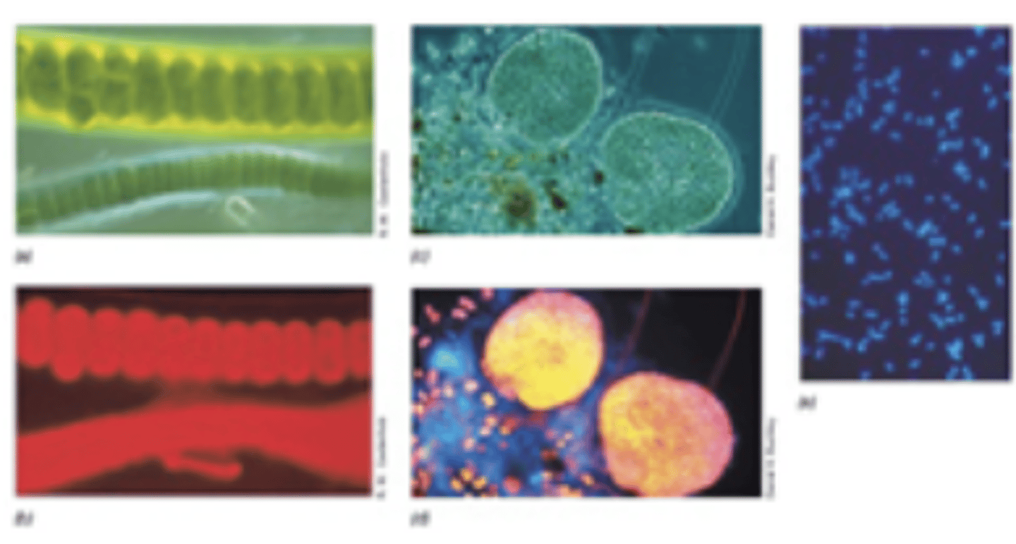 <p>What type of microscopy is shown?</p>
