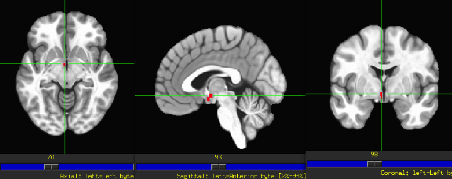 <p>Part of the diencephalon that regulates vital behaviors like sleep and eating, with both left and right hemispheres influencing motivation.</p>