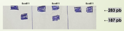 <p>¿Que corta la enzima restrictiva (<strong>Eco 81L</strong>)? ¿Como es en un paciente con anemia falciforme y un portador?</p>