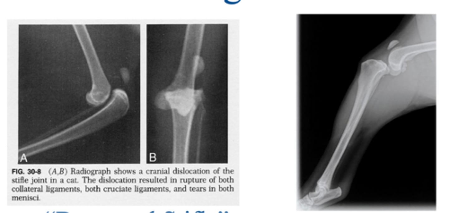 <p>what condition is shown here</p>