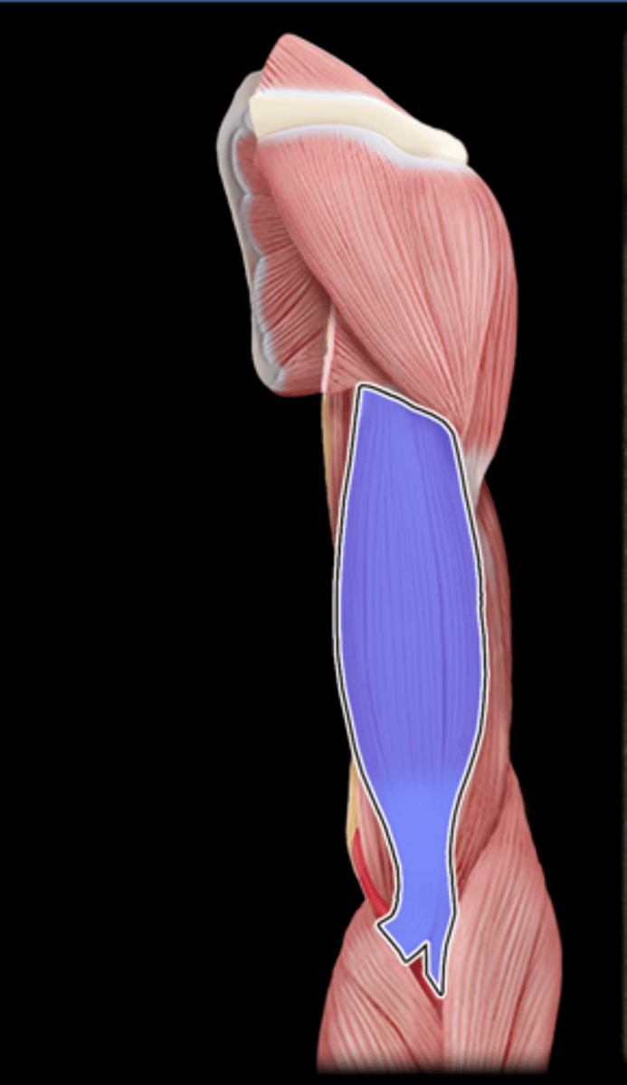 <p>What Muscle Is Highlighted?</p>