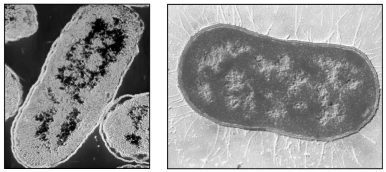<p><strong>Prokaryote Micrograph: </strong>Pili</p>