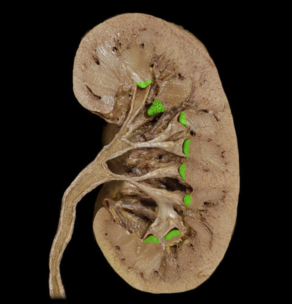 <p>The renal papilla is where urine drains from the collecting ducts into the ureters</p>