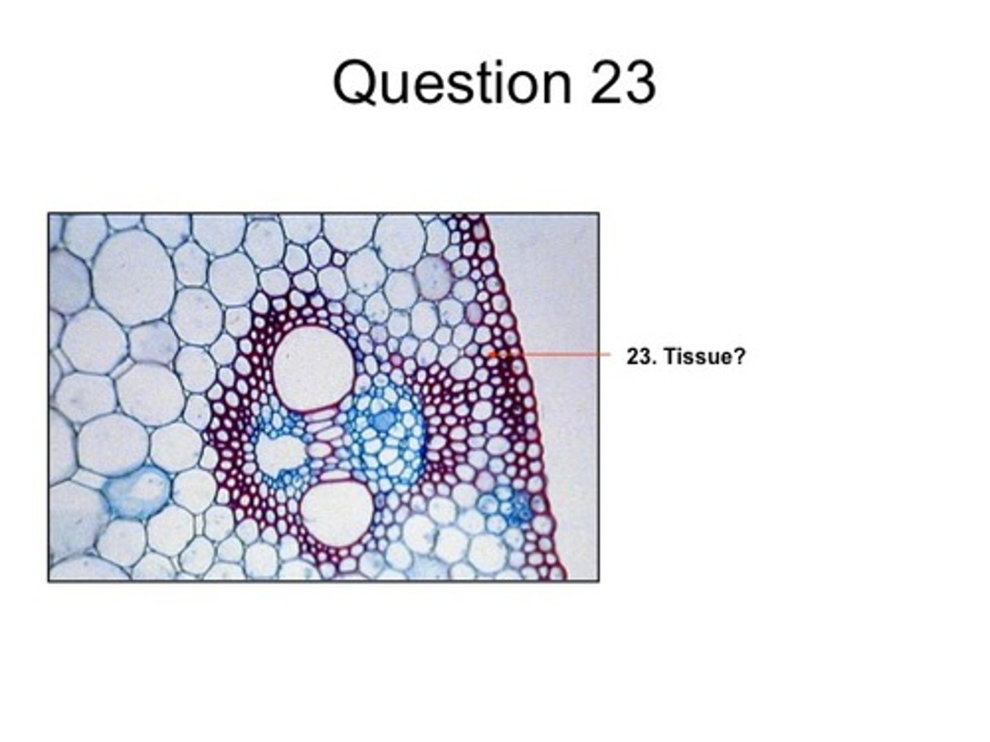 <p>Flexible cells that have provide support to plant organs; found in bundles under epidermis</p>