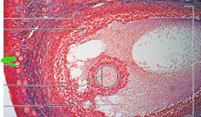 term image