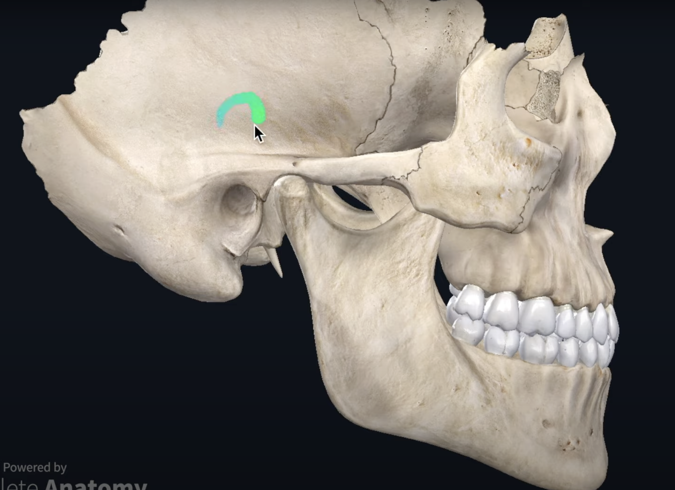 <p>What bone is this?</p>