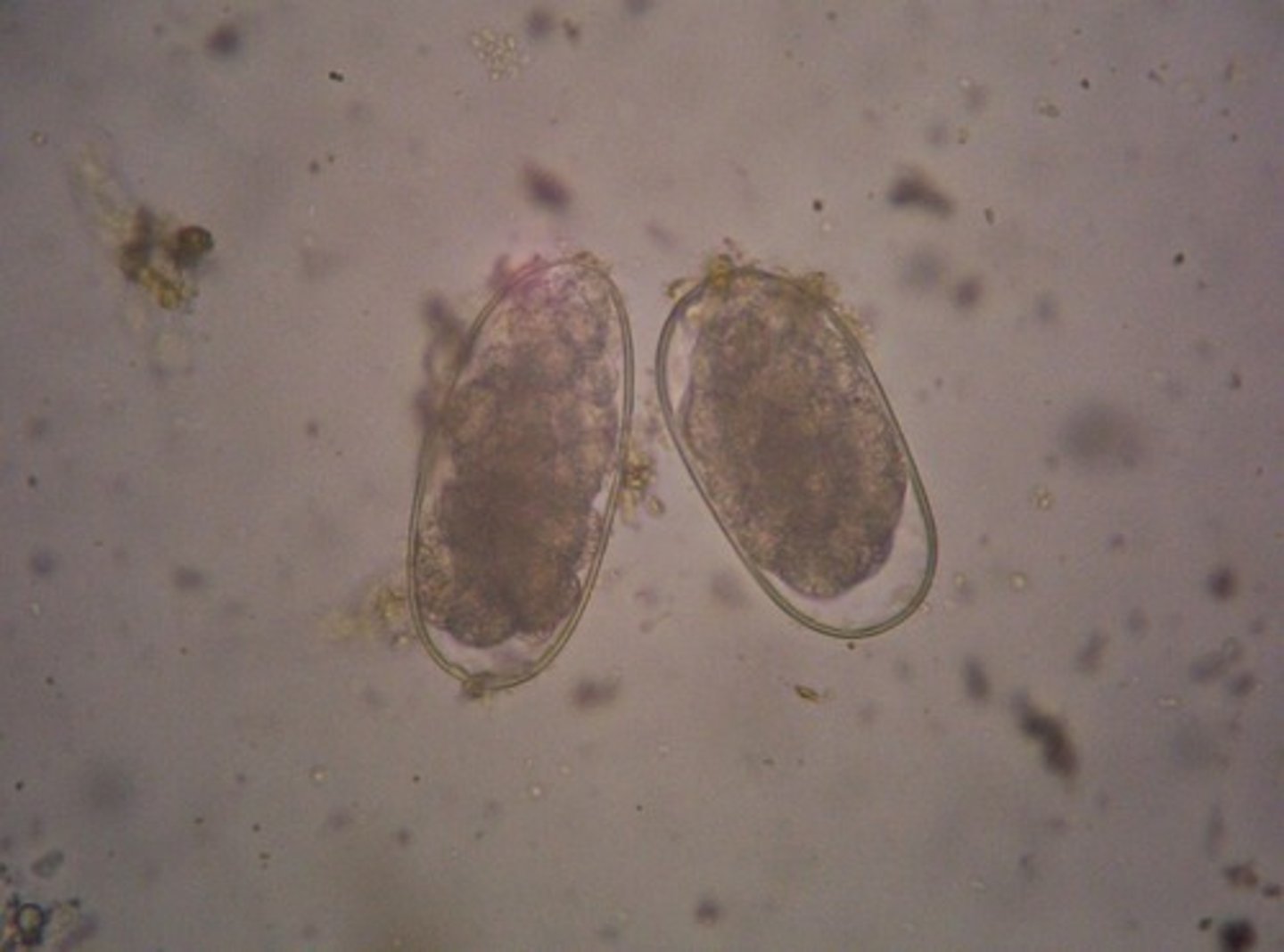 <p>This was found in a stool sample of a colicky horse. Name one kind of worm it could be.</p>