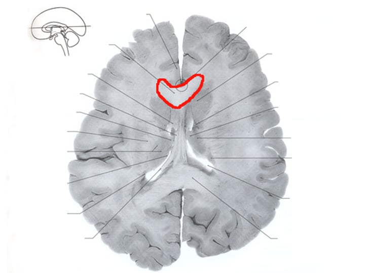 <p><strong>Connects prefrontal cortices</strong></p><p>(executive function and speech planning_</p>