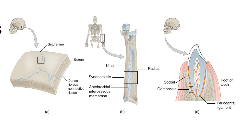 <p><strong>Sutures</strong>: Interlocking bones of skull</p><p><strong>Syndesmoses</strong>: Connected by ligaments (connect bone to bone) (ex: tibia-fibula)</p><p><strong>Gomphoses</strong>: Teeth anchored in socket</p>