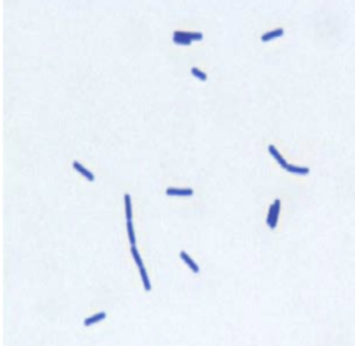 <p>positive</p>