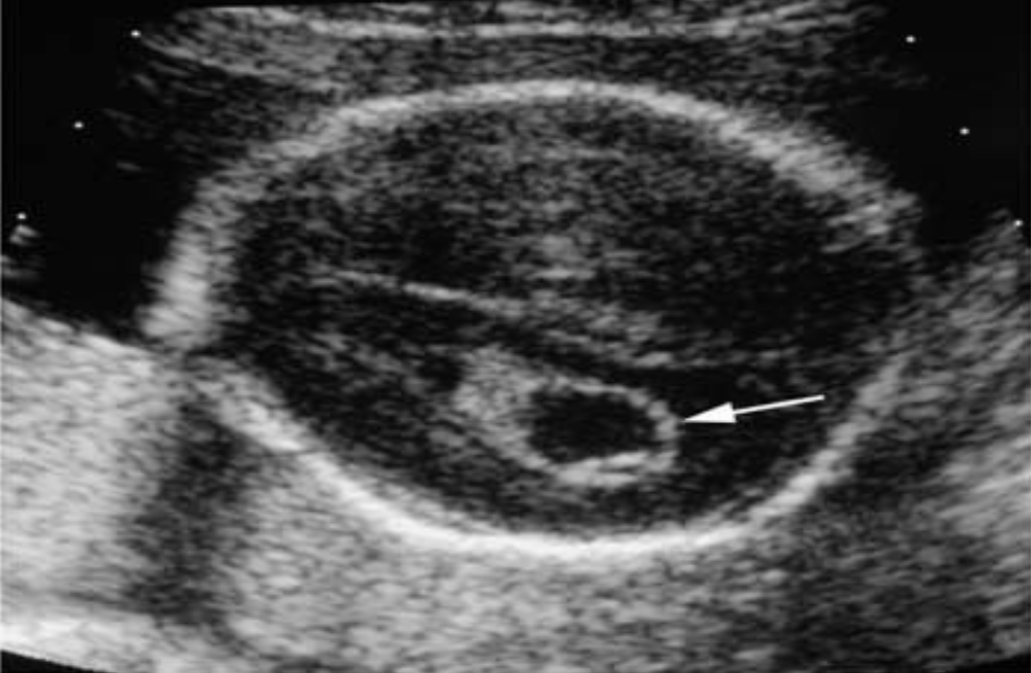 <p>What pathology is being shown?</p>