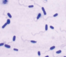 <p>one singular flagella</p>