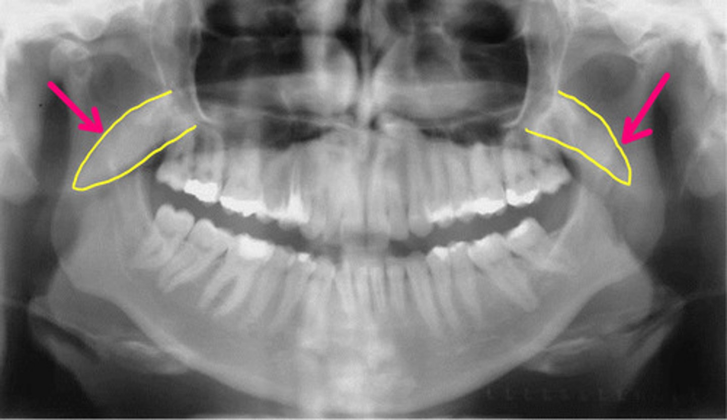 <p>Identify the structure.</p>