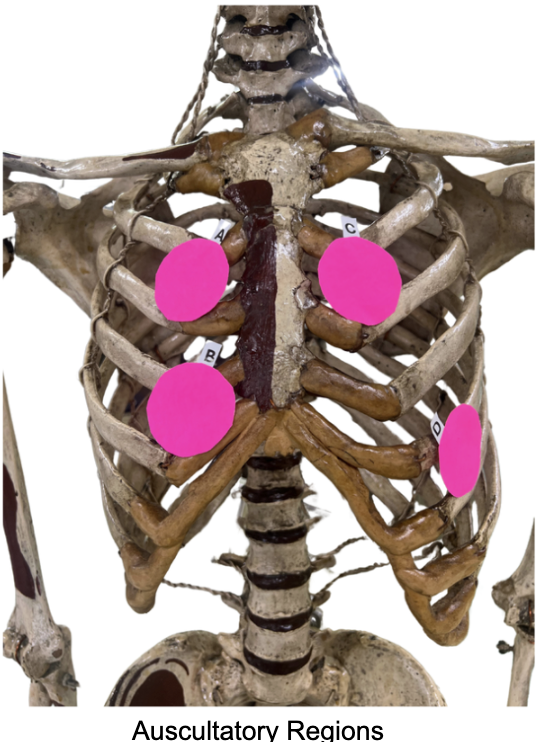 <p>Which of these is placed on the: <span>5th ICS, Left Mid-Clavicular Line&nbsp;</span></p>