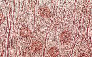 <p>Write the Latin Genus and species names of the parasite next to its picture and description:</p><p>This nematode, often found in the muscle of pork and wild game can be zoonotic and infect humans.</p>