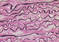 Type: Dense 

Location: Vocal cords & vertebral ligaments

Function: resist tension & allow elastic recoil