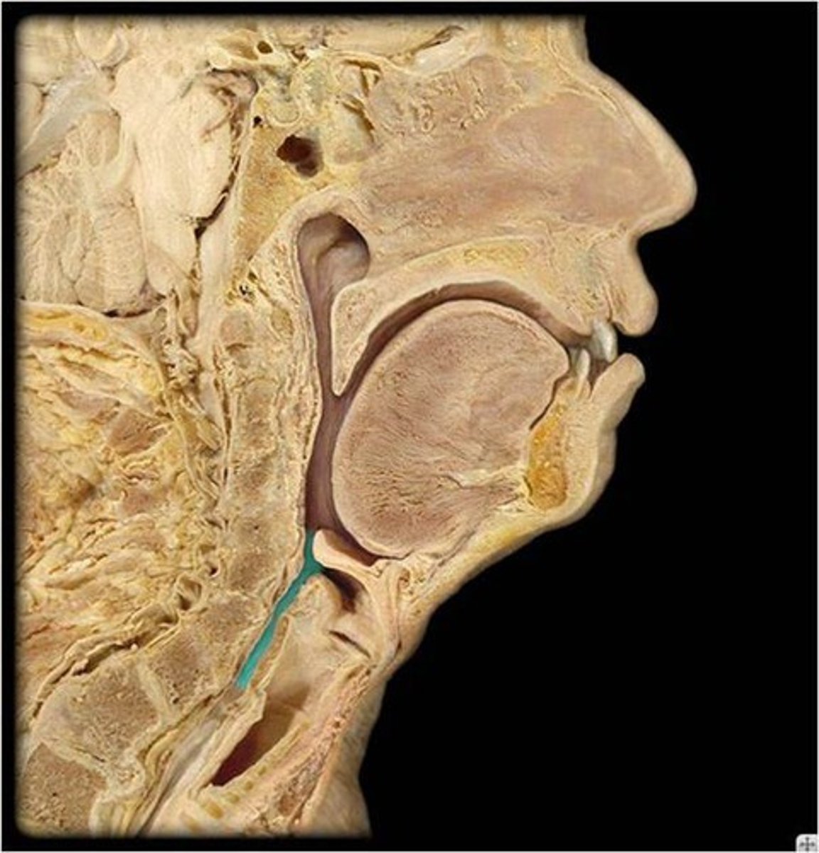 <p>Identify this specific region.</p>