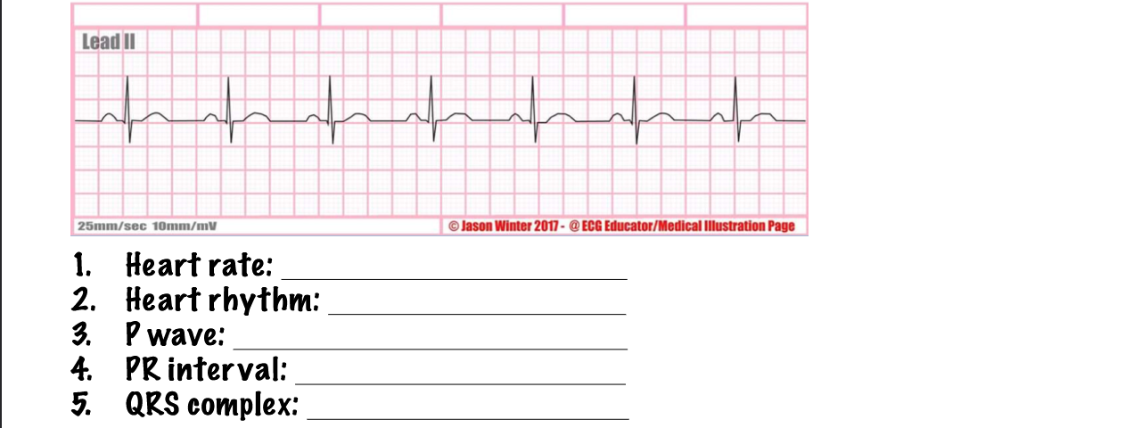 <p>what type of rhythm is this? answer the questions</p>