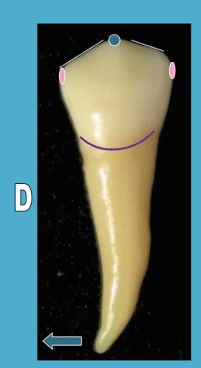 <p>mesial MR is higher/more occlusal in crown than distal MR</p>