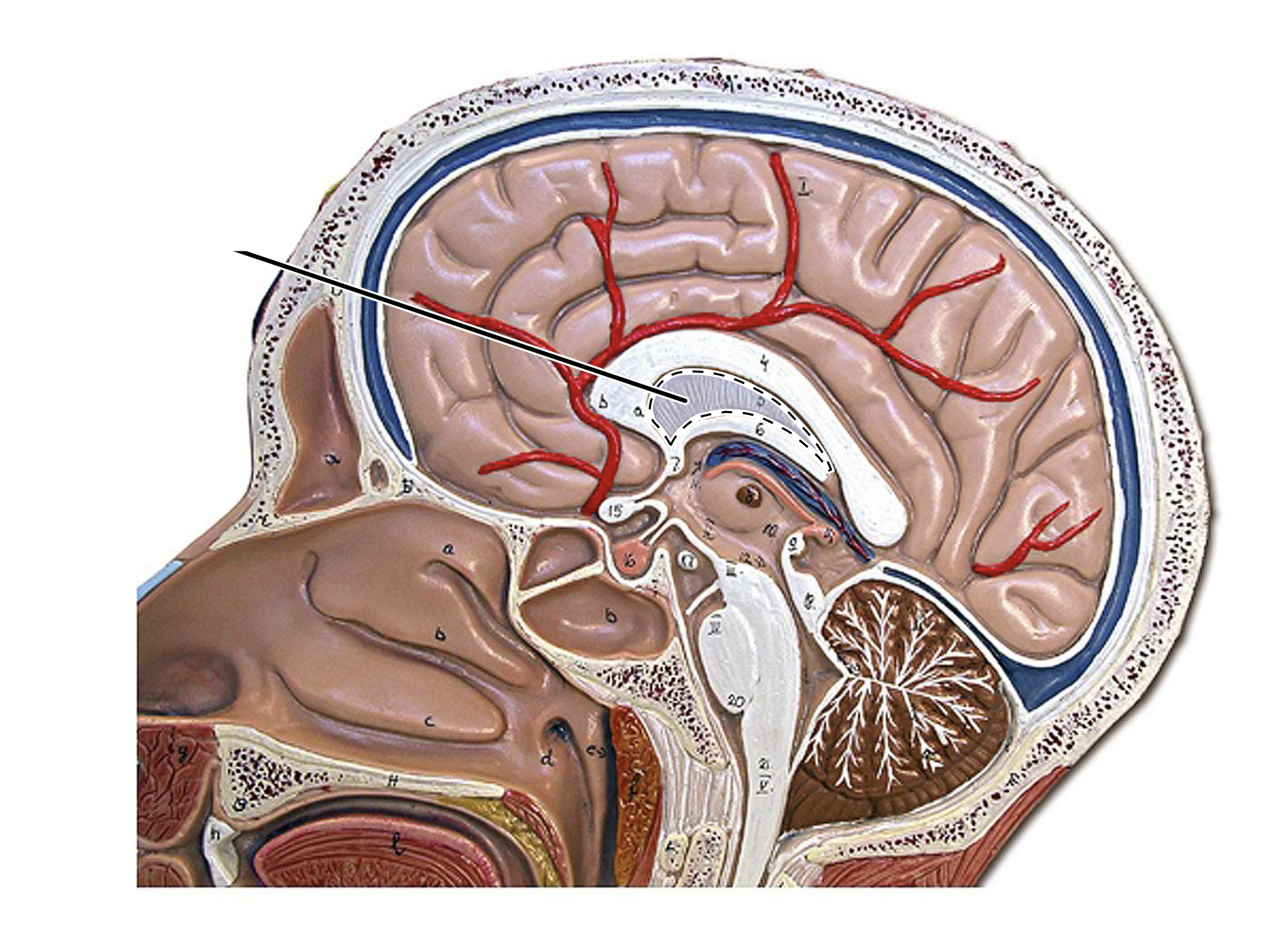 term image