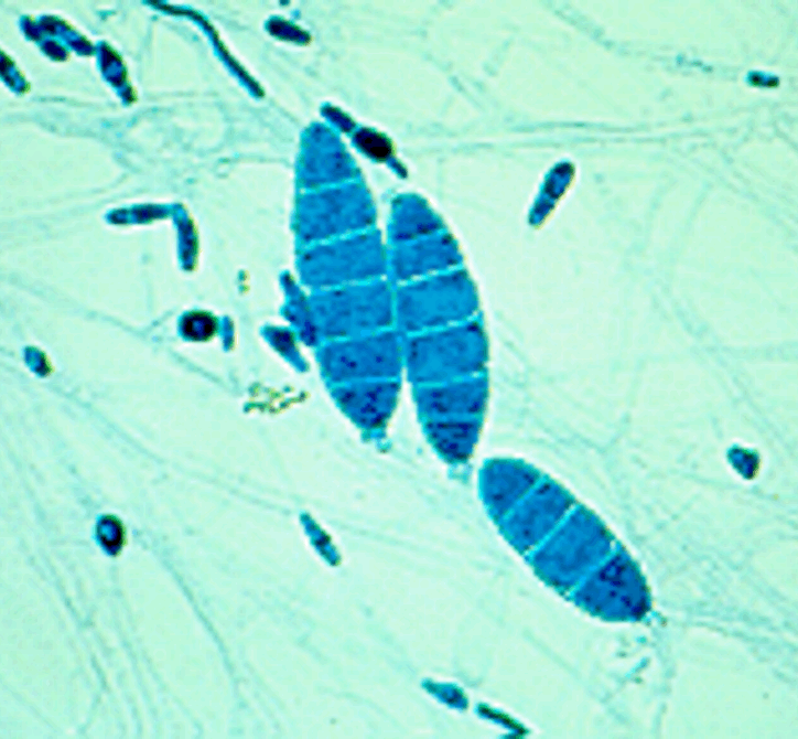 <p>What is the parasite shown in the image?</p><p>Utilize the following characteristics:</p><p>•<span>This is a thin-walled macroconidia with no more than 6 cells - commonly has 6.</span></p><p>•Both humans and pets can be infected with this parasite.</p><p><span>•Infection occurs due to contact with the environment.</span></p><p><span>•Treating the pet alone does not prevent recurrence of this infection.</span></p><p><span>•Usually not an issue unless the animal and/or human is immunocompromised.</span></p>