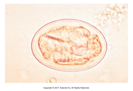<p>First stage larva within egg shell, ovoviviparous</p>