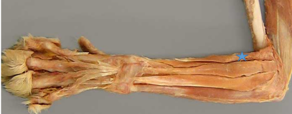 <p>Extensor carpi radialis m. (blue star)</p>