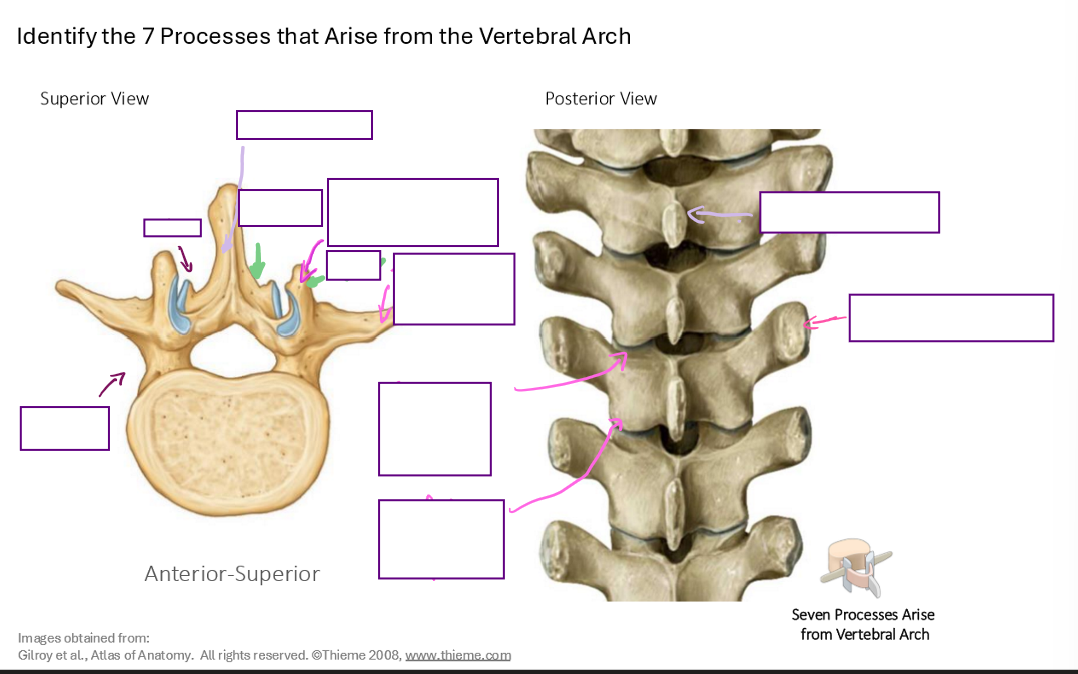 <p>Identify the 7 processes that arise from the vertebral arch (name structures that are being pointed at)</p>