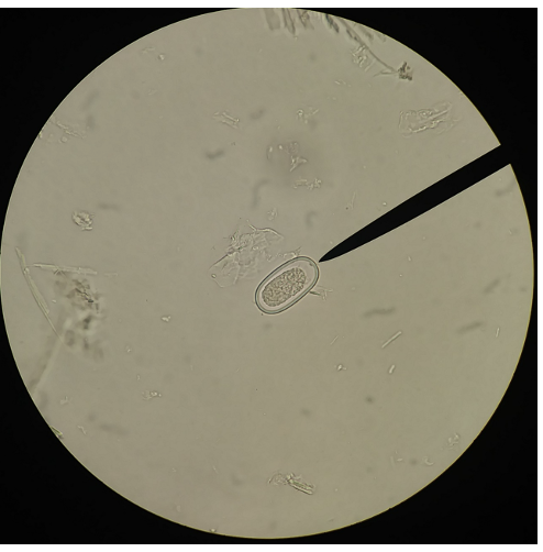 <p>What disease does this species cause?</p>