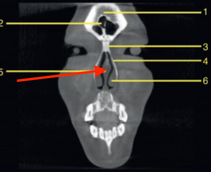 <p>identify structure </p>