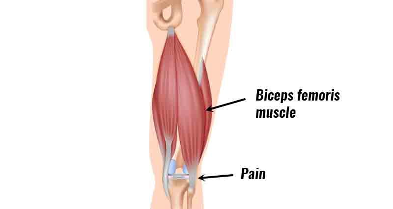 <p>Knee (Hamstring Group) Muscle Location:</p>