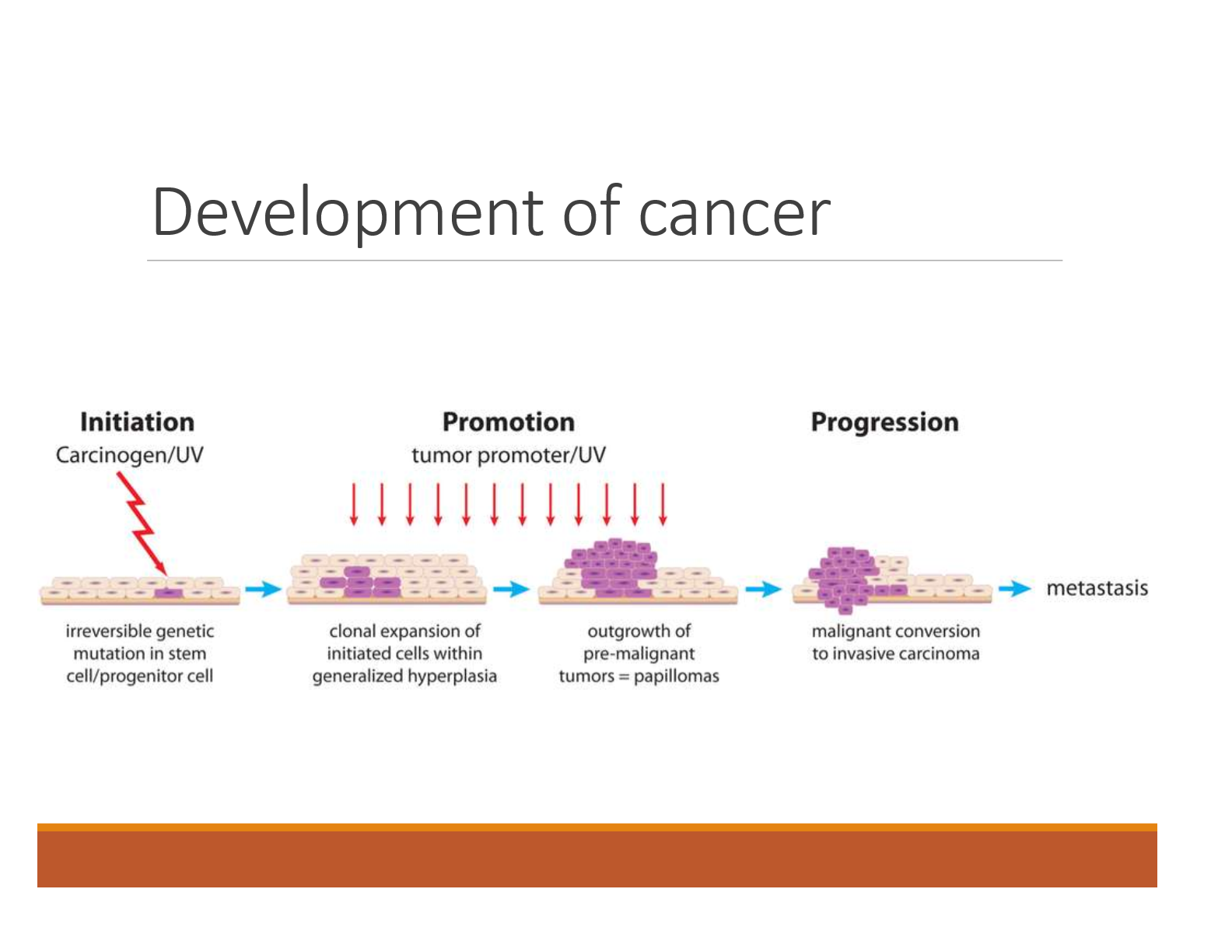 <p><u>Initiation:</u> Carcinogen/UV</p><ul><li><p>Irreversible genetic mutation in stem cell/progenitor cell</p></li></ul><p><u>Promotion:</u> Tumor promoter/ UV</p><ul><li><p>Clonal expansion of initiated cells within generalized hyperplasia</p></li><li><p>Outgrowth of pre-malignant tumors = papillomas</p></li></ul><p><u>Progression:</u> </p><ul><li><p>Malignant conversion to invasive carcinoma</p></li><li><p>Metastasis</p></li></ul><p></p>