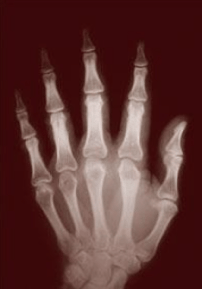 <p>If something is ______, this means it does not have a particular illness.</p>