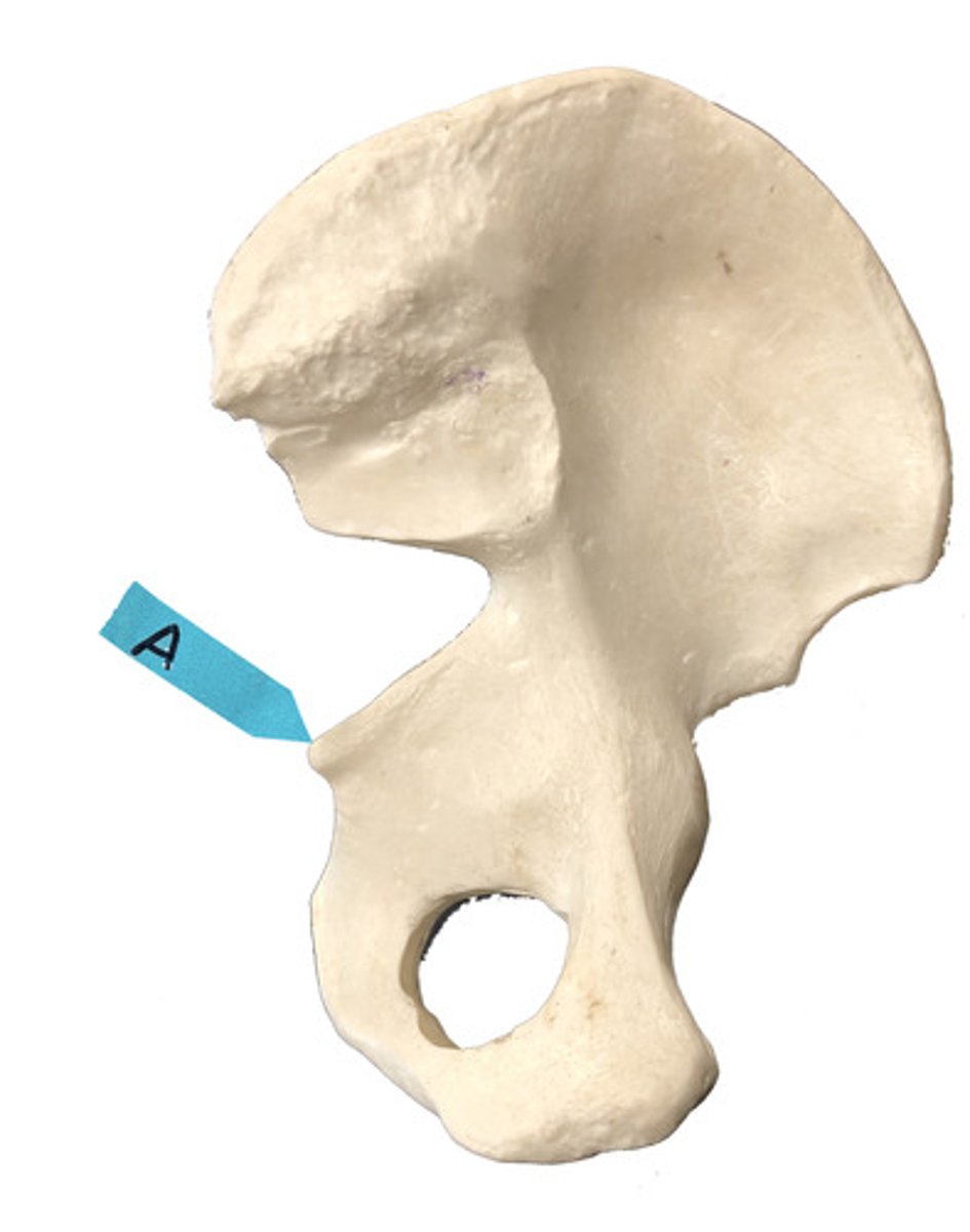 <p>Identify this bone marking.</p>