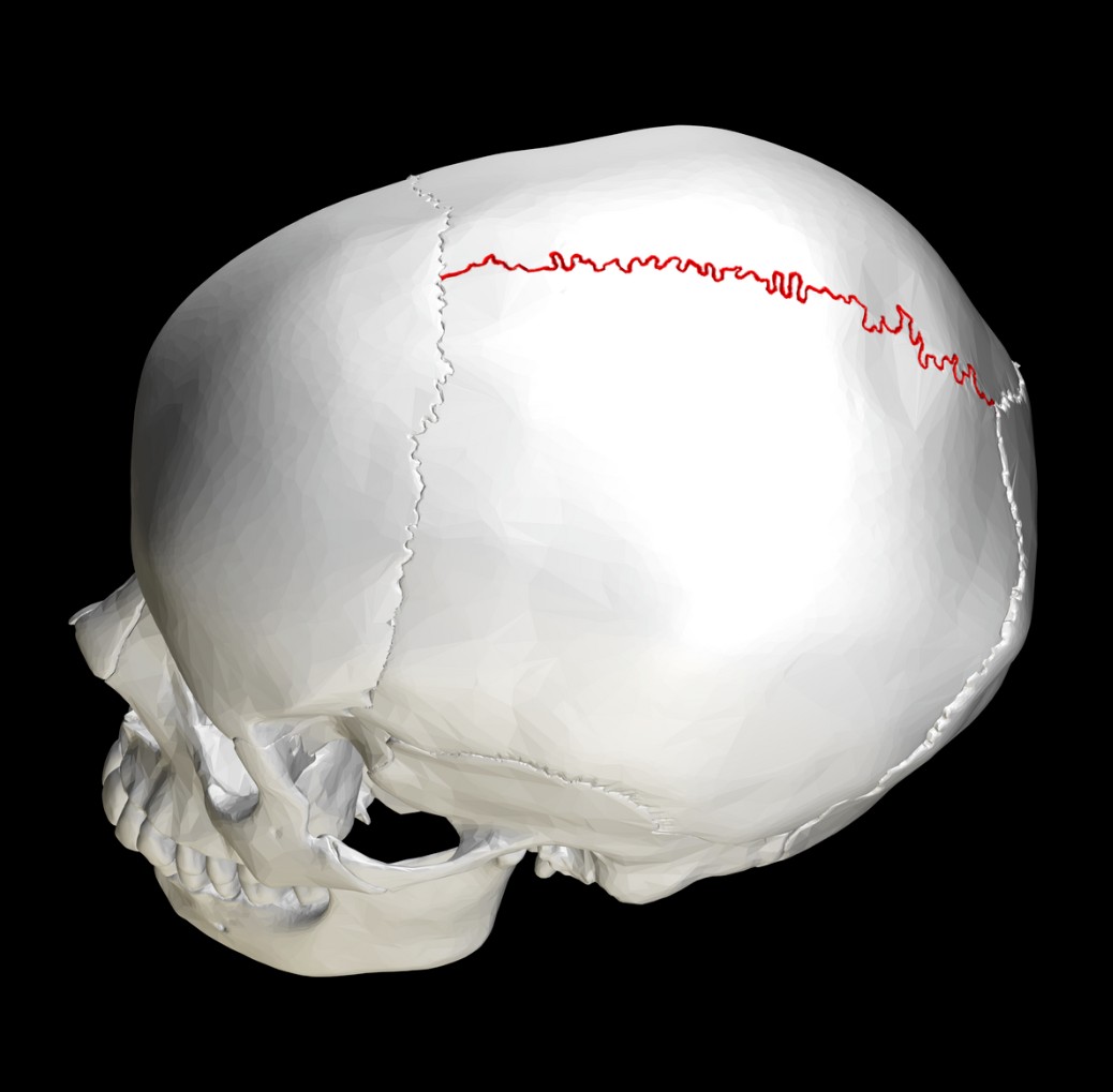 <p>SUTURE</p>