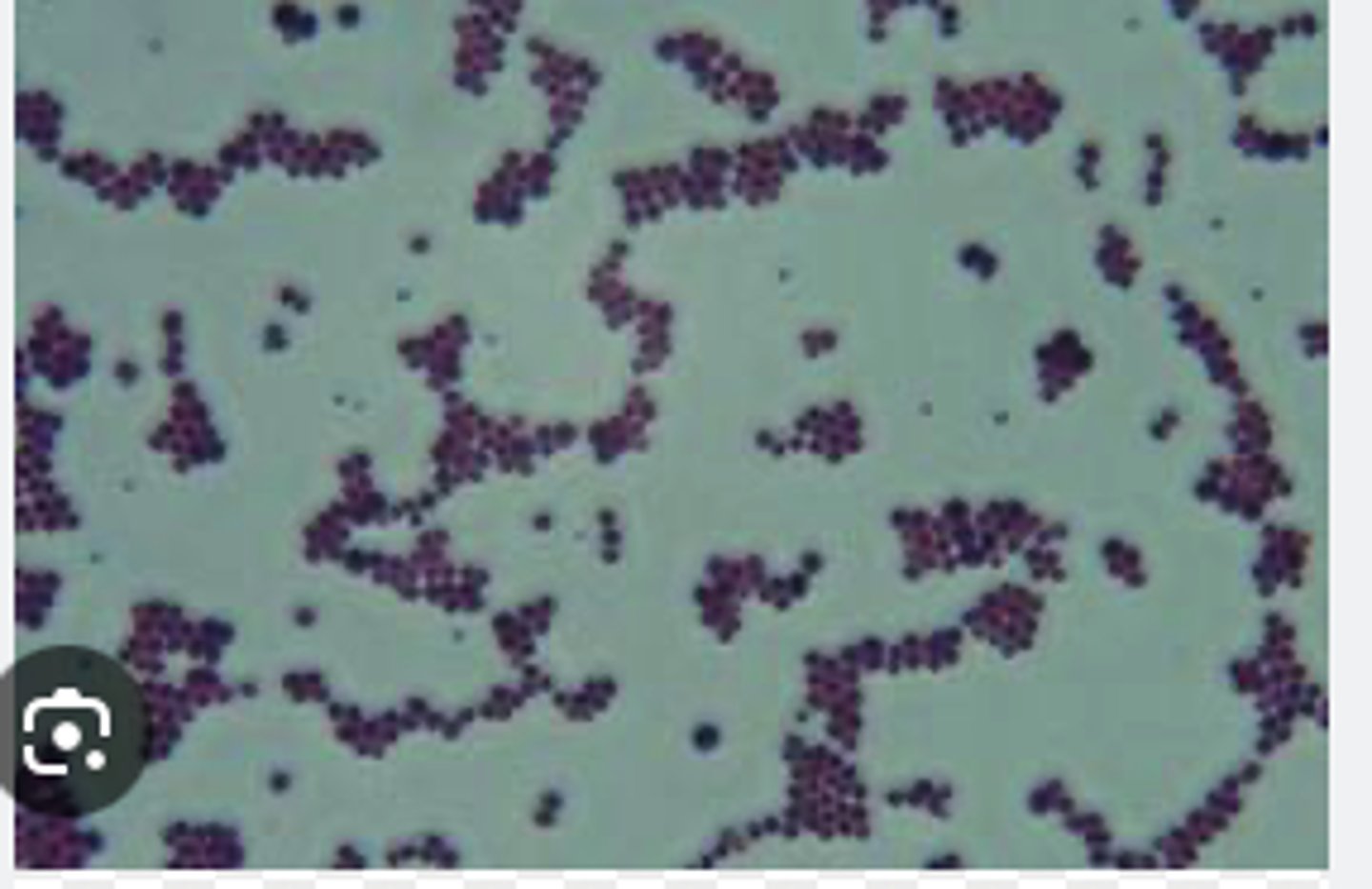 <p>A dog presented with pyoderma of the face and limbs. Material from pustules was plated on Blood (BA) and MacConkey (MAC) agars and incubated overnight at 350C. BA plates are provided. There was no growth on MAC.</p><p>Describe the cytology findings on your peep down the scope</p>