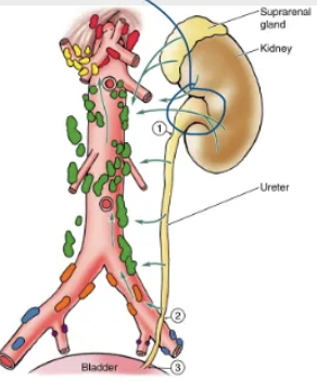 <p>1.junction of renal pelvis +ureter</p><ol start="2"><li><p>when it crosses the pelvis brim</p></li><li><p>when enterin bladder</p></li></ol><p></p><p>These are sites of obstructions by kidney stones</p><p></p>
