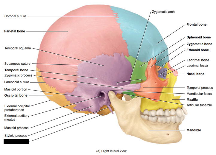 <p>State and identify what part of the cranial bone is being pointed out and censored. </p>
