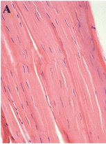 <p>What structure is shown in this?</p>