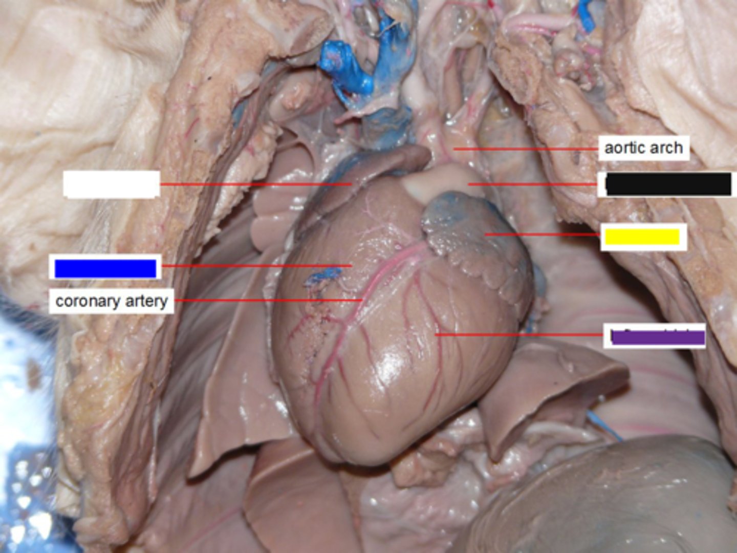 <p>Pumps deoxygenated blood to lungs via pulmonary trunk — Anterior right ventral chamber of heart (blue box)</p>
