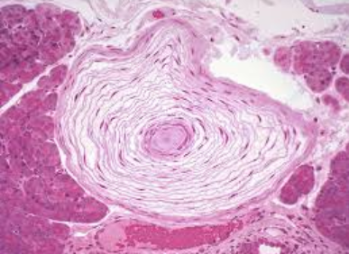 <p>What type of touch receptor is this?</p>