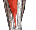 tarsals and metatarsals (navicular)