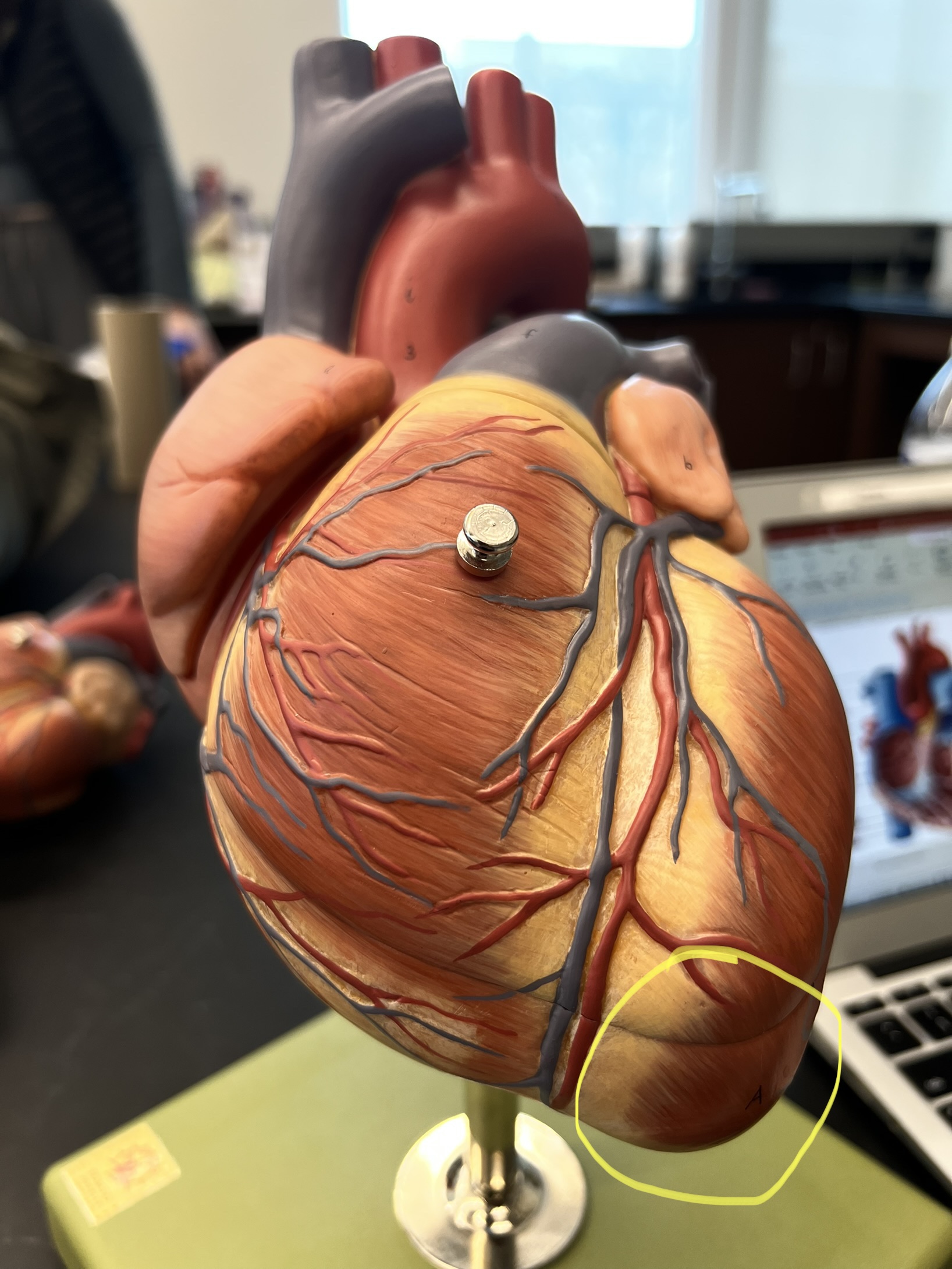 Name the heart structure.