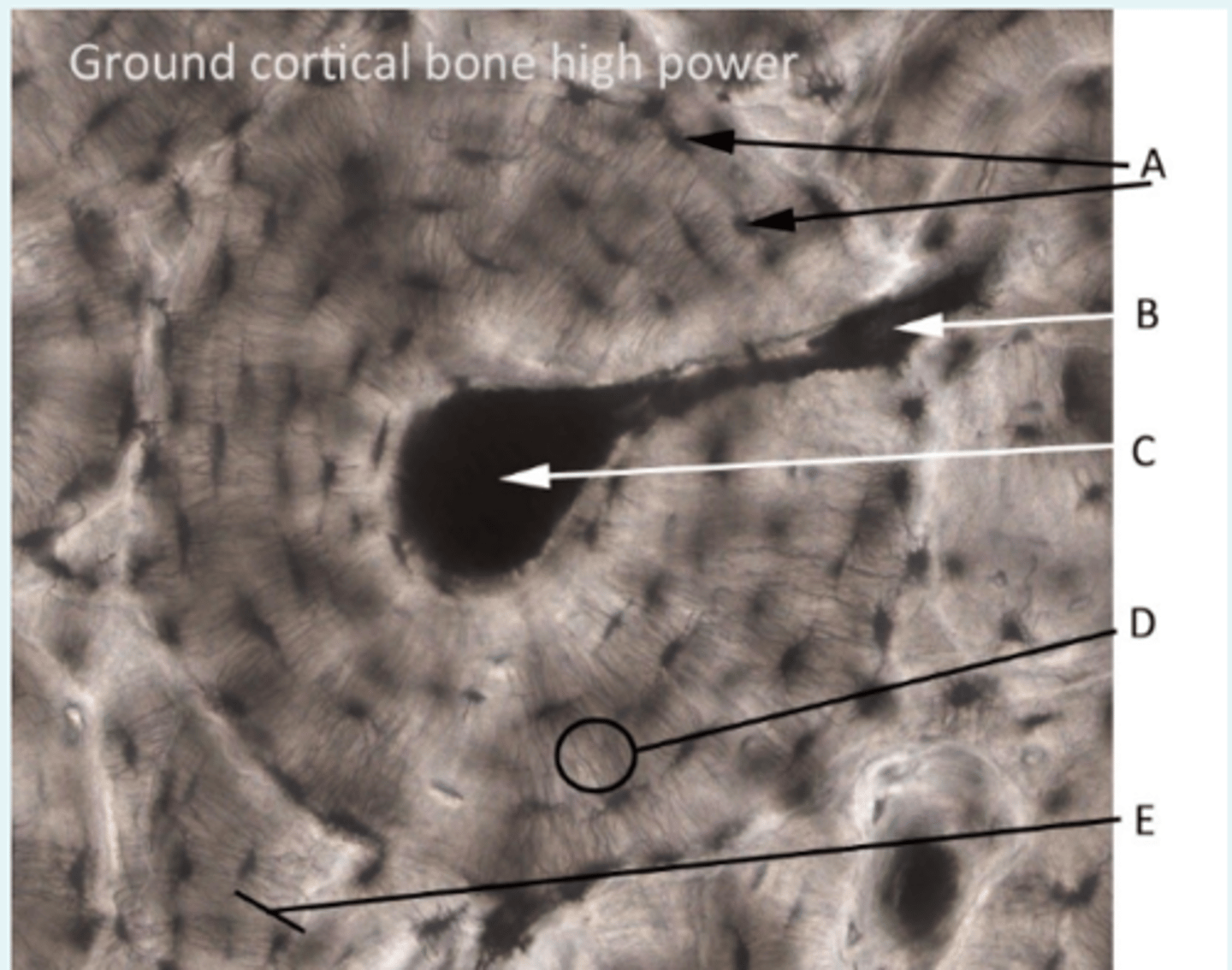 <p>A = Osteocytes in lacunae</p><p>B = Volkmann's (perforating) canal</p><p>C = Haversian (central) canal</p><p>D = Canaliculi</p><p>E = Interstital lamella</p>